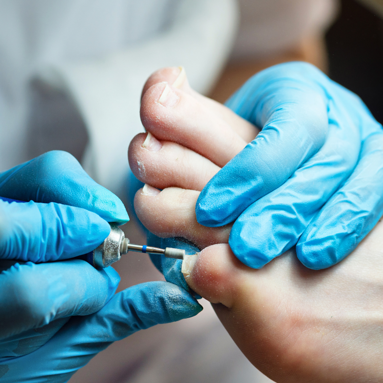 Fußpflegebehandlung mit modernem Fräser